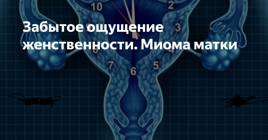 Миома матки. Психосоматика? Терапия творчеством