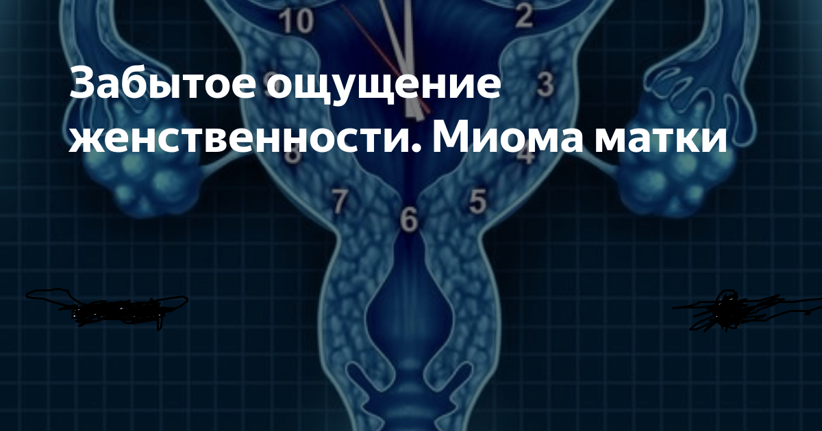 Психосоматика матка. Миома матки Луиза Хей таблица. Миома матки психосоматика. Луиза Хей миома аффирмации.